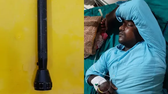 katwa hospital-s doctor took out the entire torch from the anus of the young man