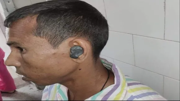 fake doctor apply msil in man ear in katwa
