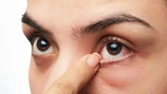 Eye diseases in Monsoon (unsplash)