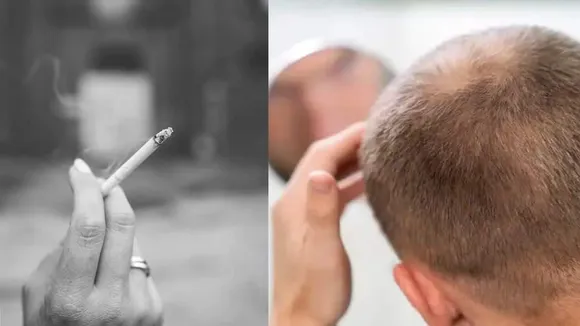 Smoking and Hair Fall