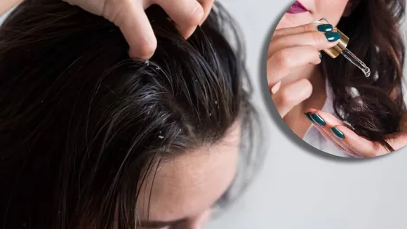diy homemade ayurvedic hair masks amla bhringraj coconut oil rice water effective for premature graying hair white hair