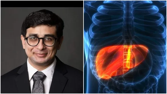 Fatty Liver, Fatty Liver Problem, Health Tips, Food ,Bangla News, Latest Bangla News, News in Bangla, Bengali News, Latest Bengali News, News in Bengali"