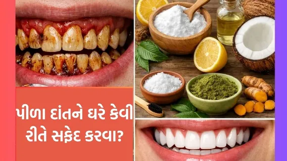 teeth whitening at home