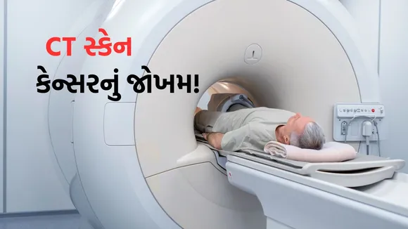 ct scan increase cancer risk | ct scan side effects