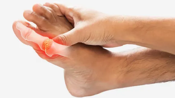 How to reduce uric acid reasons