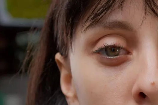 ઉનાળામાં ફોટોકેરાટાઈટીસ