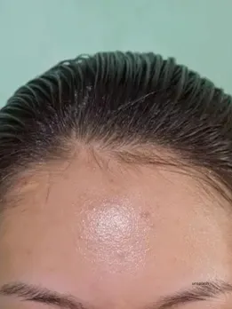 Monsoon Skincare Tips : (unsplash)