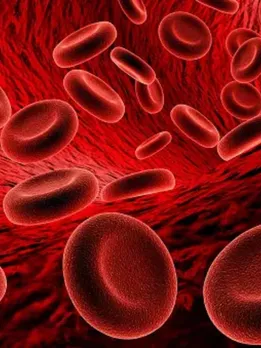 Benefits Of Raisin Water Raisin, Kishmish benefits for hair and skin hemoglobin