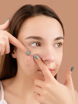 skin care tips winter applying ice on your face help to reduce acne beauty tips gujarati news
