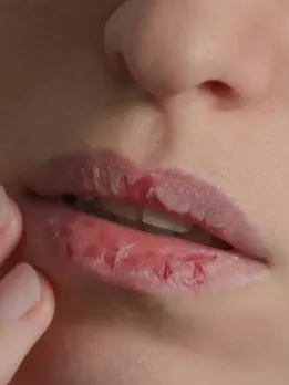 Lip care tips how to keep lips soft in winter skincare tips health tips gujarati news