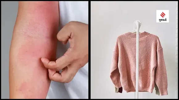 how to avoid allergy in Winter Skincare tips gujarati news