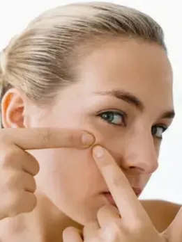 Blackheads home remedies skincare tips beauty tips gujarati news