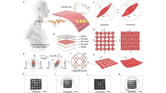AI adhesive patch | voice disorder treatment | UCLA voice patch