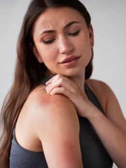 summer health tips heat rashes