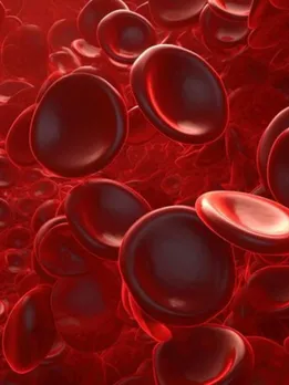 Hemoglobin Deficiency causes news