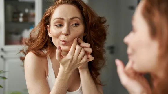 Skin Acne Due to Vitamin Defiecincy