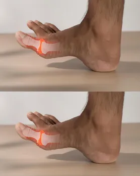 Uric acid Health tips