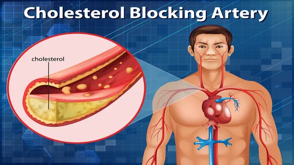 cholesterol level control | cholesterol