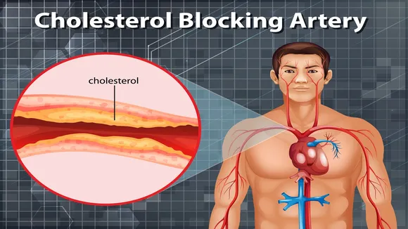 high cholesterol level control tips