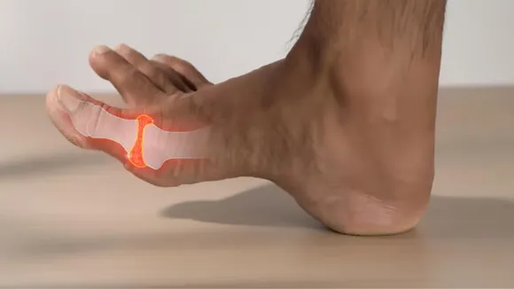 Uric Acid Home remedies Diet tips in gujarati