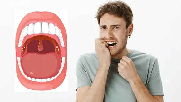 Oral Health Symptoms, signs of oral disease, મોઢાનું સ્વાસ્થ્ય, મોઢાના સ્વાસ્થ્યના લક્ષણો