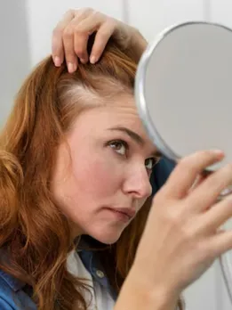 dandruff issue home remedies