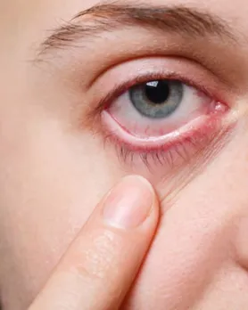 tips to increase eyesight