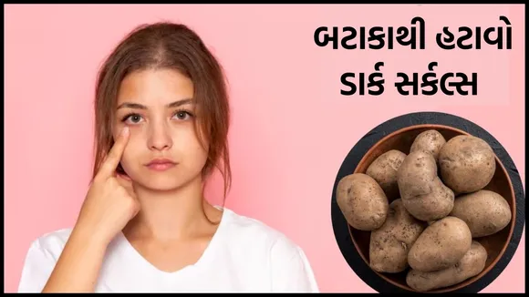 potato for dark circles, dark circles