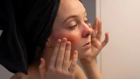 Monsoon skin care routine for combination skin