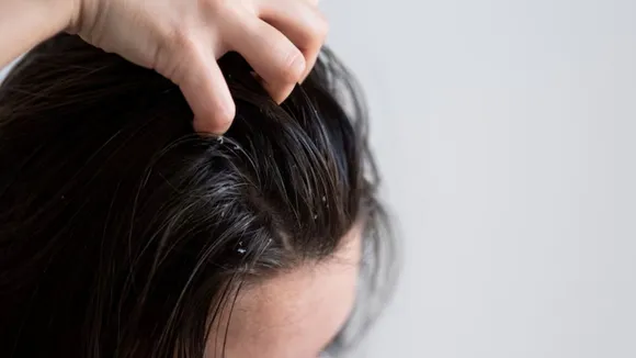 hair care in rain, hair care tips, ચોમાસાની ઋતુ