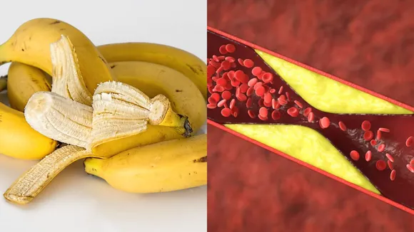 banana benefits for cholesterol | કેળા કોલેસ્ટ્રોલને નિયંત્રિત કરવામાં મદદ કરે