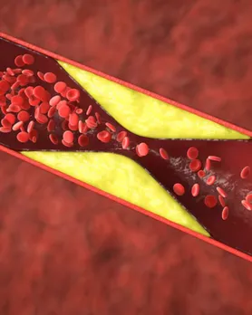 banana cholesterol controlling tips