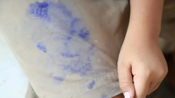 ink remover from clothes, કપડા પરથી શાહી દૂર કરવાના ઉપાય