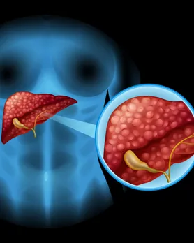 ફેટી લિવર ડિટોક્સ ડ્રિંક
