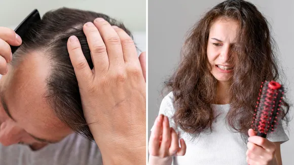 Hair Fall Reasons | Hair Fall Natural Remedies | Hair Care Tips