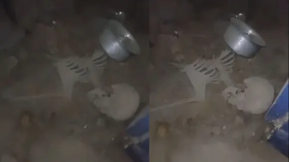 Hyderabad Skeleton, Hyderabad