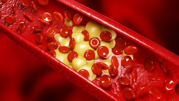 કોલેસ્ટ્રોલ કંટ્રોલ કરવા શું ખાવું અખરોટ ખાવાના ફાયદા હેલ્થ ટિપ્સ