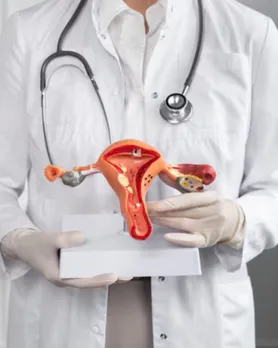 સ્ત્રીઓમાં PCOD | PCOD લક્ષણો | PCOD અથવા PCOS | લીમડાના તેલના ફાયદા | PCOD સારવાર | PCOD ઘરેલું ઉપચાર