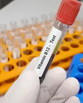 વિટામિન બી 12 ની ઉણપ, કારણો, લક્ષણો, ઉપાયો