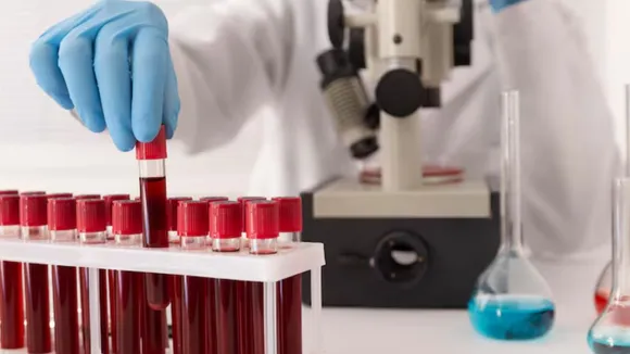 ન્યુરો ફિલામેન્ટ લાઇટ ચેઇન મગજ માટે સચોટ ટેસ્ટ હેલ્થ ટીપ્સ