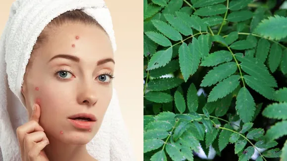 નવરાત્રી 2025 લીમડાના પાનના ફેસપેક ના ફાયદા નવરાત્રી બ્યુટી ટિપ્સ