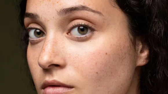 કુદરતી રીતે ડાર્ક સ્પોટ દૂર કરવા માટેની ટિપ્સ બ્યુટી ટિપ્સ