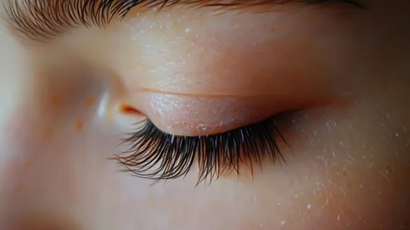 eyelash dandruff 1