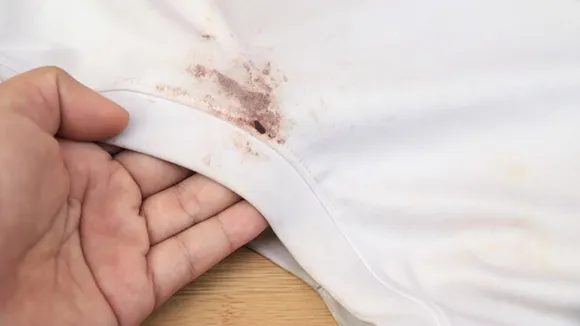 mould stain clothes FI