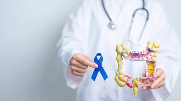 colon cancer FI