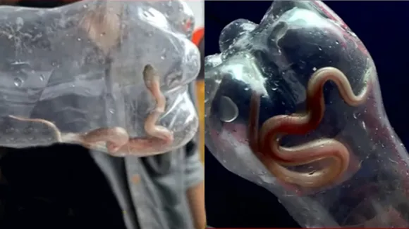 Snake Bite, Palakkad Govt Hospital 