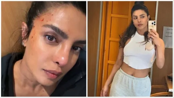 Priyanka Chopra, Priyanka Chopra injured, Priyanka Chopra injury, Priyanka Chopra shooting injury, Priyanka Chopra bruised, heads of state