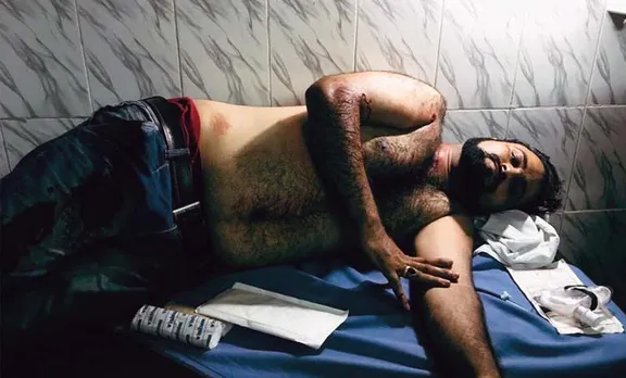 Dr Kafeel Khan's brother Shot at