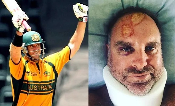 മാത്യൂ ഹെയ്‌ഡന് സര്‍ഫിങ്ങിനിടെ ഗുരുതര പരുക്ക്; ആരാധകഹൃദയത്തെ നോവിച്ച് ചിത്രം വൈറലാകുന്നു