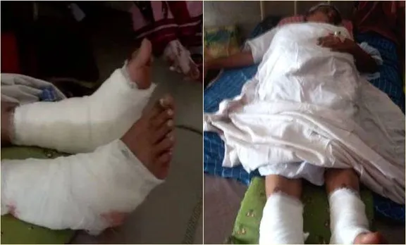 ഇടതുകാലിന് വേണ്ടിയിരുന്ന ശസ്ത്രക്രിയ നടത്തിയത് വലതുകാലിന്; പിഴവ് നിലമ്പൂര്‍ ജില്ലാ ആശുപത്രിയില്‍